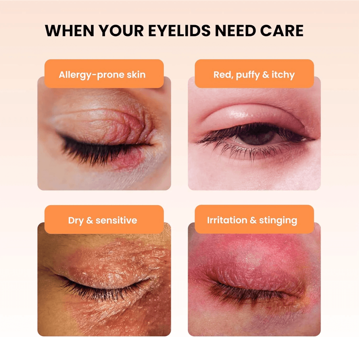 BlephaDerm Eye Care Products Thea