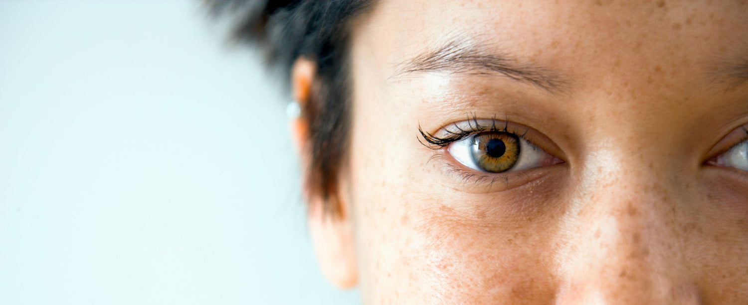 L'œil droit d'une femme montrant des signes de maladies oculaires
